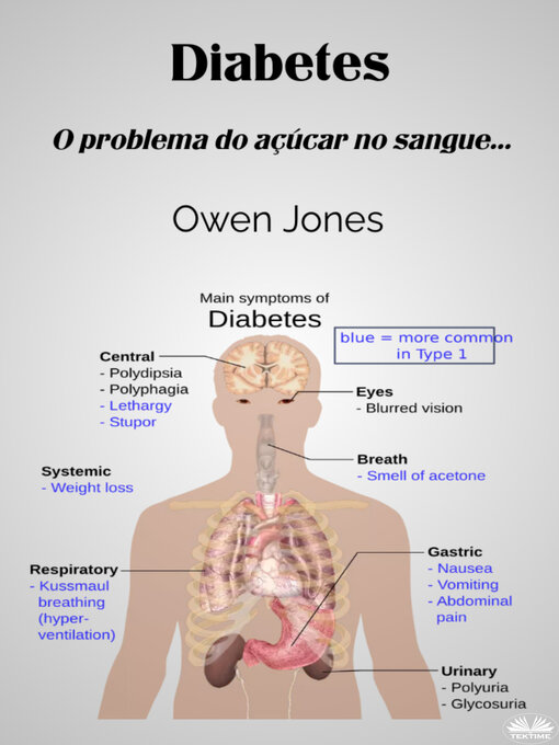 Title details for Diabetes by Owen Jones - Available